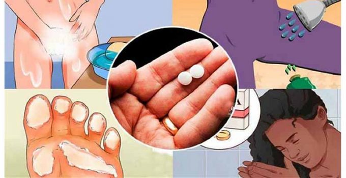 ¿Sabes los usos de la aspirina?